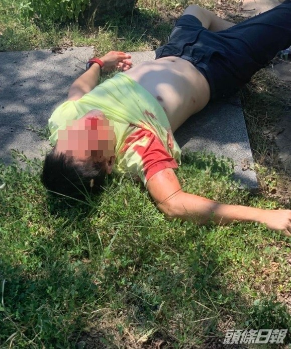 林志穎當日發生意外被救出時，滿臉鮮血。